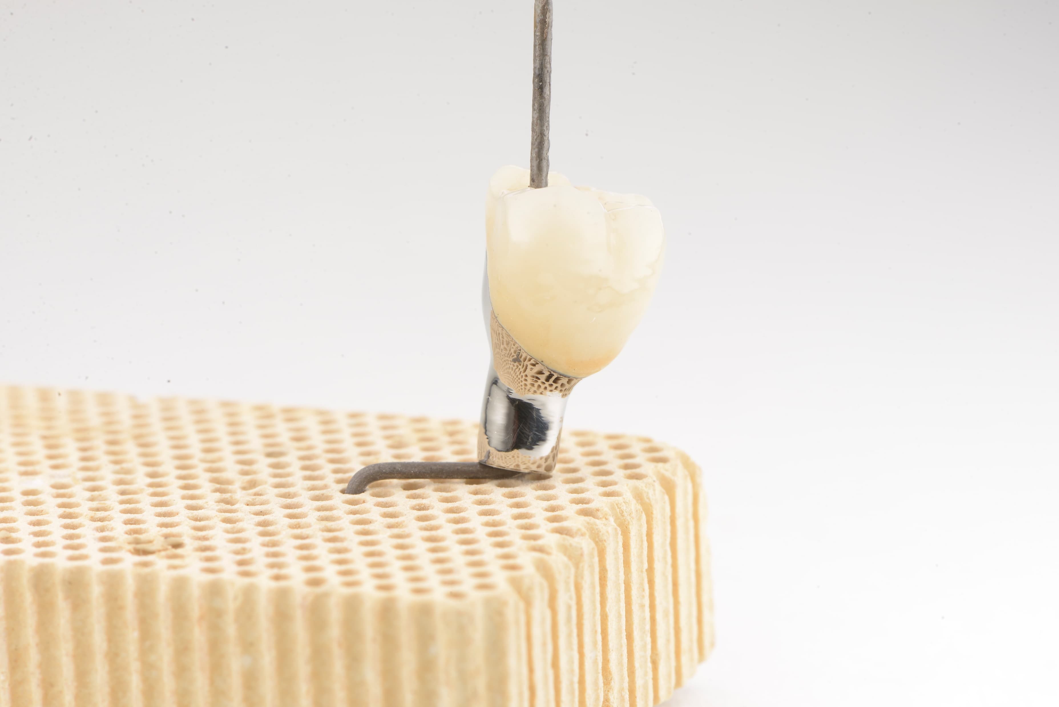 Implants Céramiques